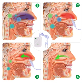 BioNase Nosies Rinito Gydymo Terapijos Prietaisas Sinusitas Paramos Nosies Išgydyti Prietaiso Išgydyti Nosies Alergija Lazerio Šviesa Sveikatos Priežiūros
