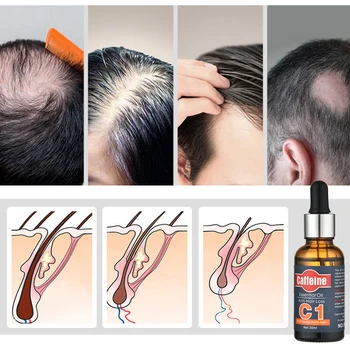 Plaukų Augimo Esmė Anti Plaukų Slinkimas Eterinis Aliejus Remonto Plaukų Auginimo Galvos Odos Gydymas Moterims, Vyrams, Plaukų Priežiūros Produktai
