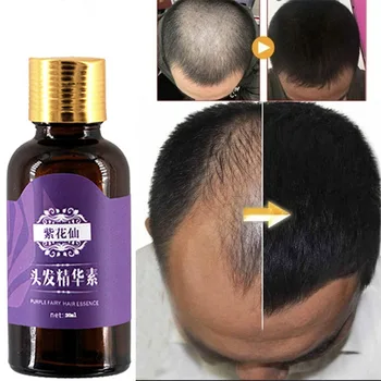 Plaukų Slinkimas Produktų, Natūralių, Be Jokių Pašalinių Efektų Augti Plaukai Greičiau Atauga Plaukų Augimo Produktai